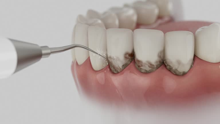 Trusted Teeth Cleaning And Checkup service in Crown Point, IN - Dentist Open Now